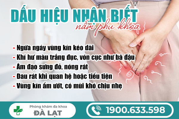 Hình ảnh minh họa